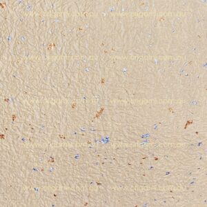 Momi Yellow - 25.5cm x 36cm